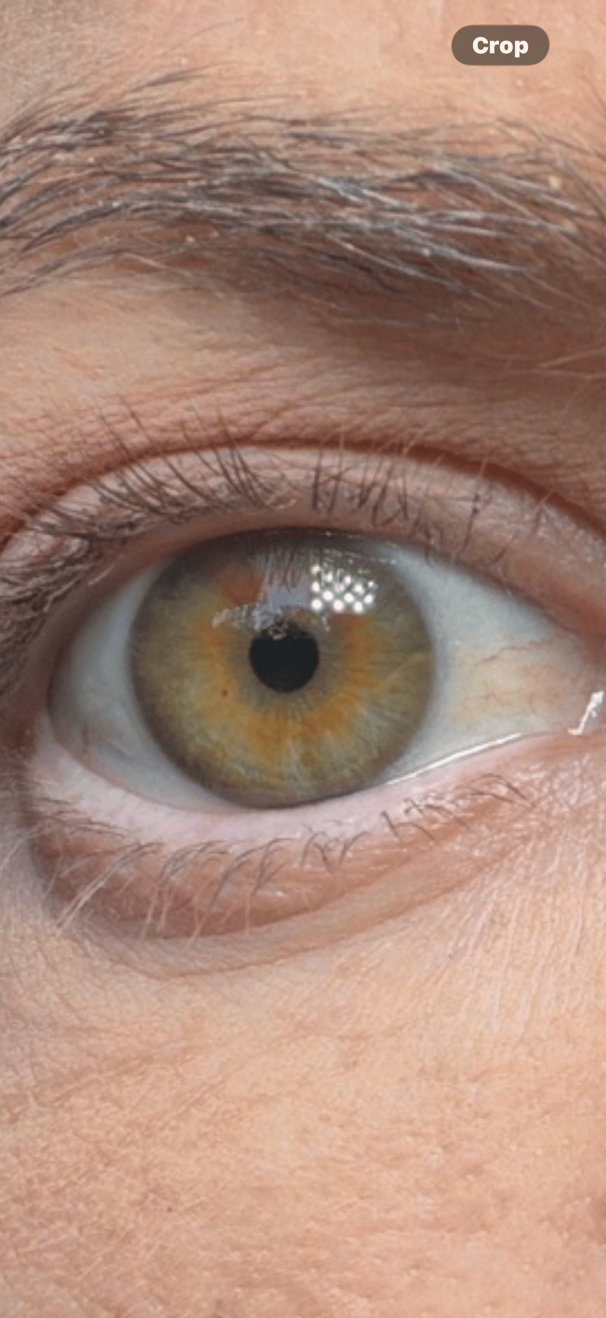 taking a closeup photo of your eyeball
