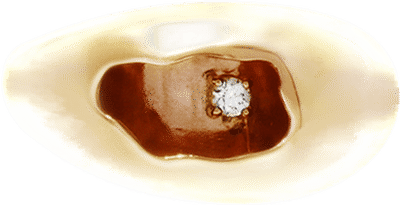 18K Diamond Dome Ring