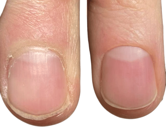 Fyle Hand & Nail Care