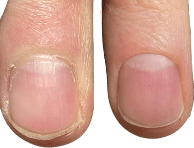 Fyle Hand & Nail Care System
