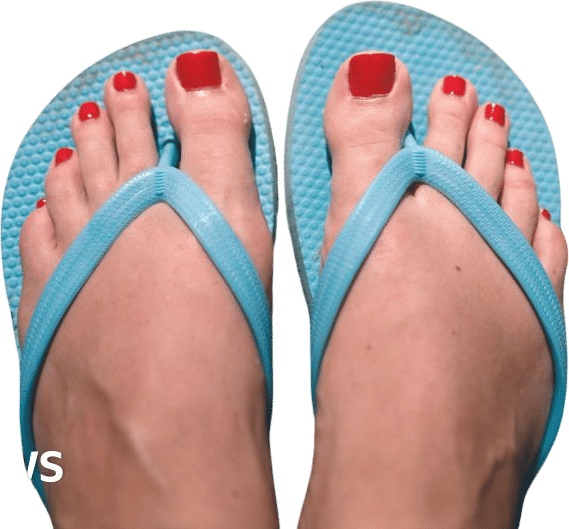 rejecting flip flops
