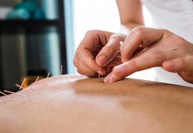 Acupuncture & Chinese herbs (from my acupuncturist).
