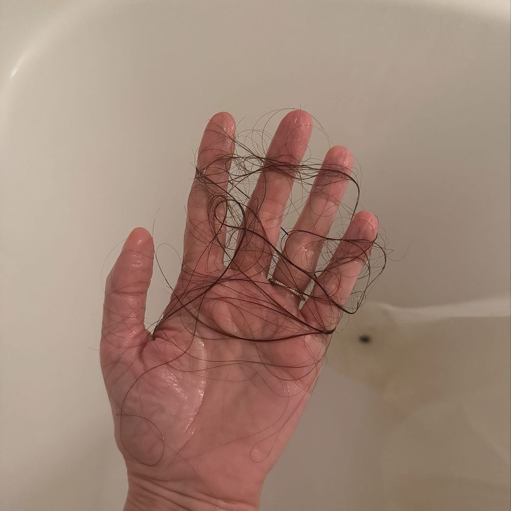 Losing Your Hair From Chemotherapy