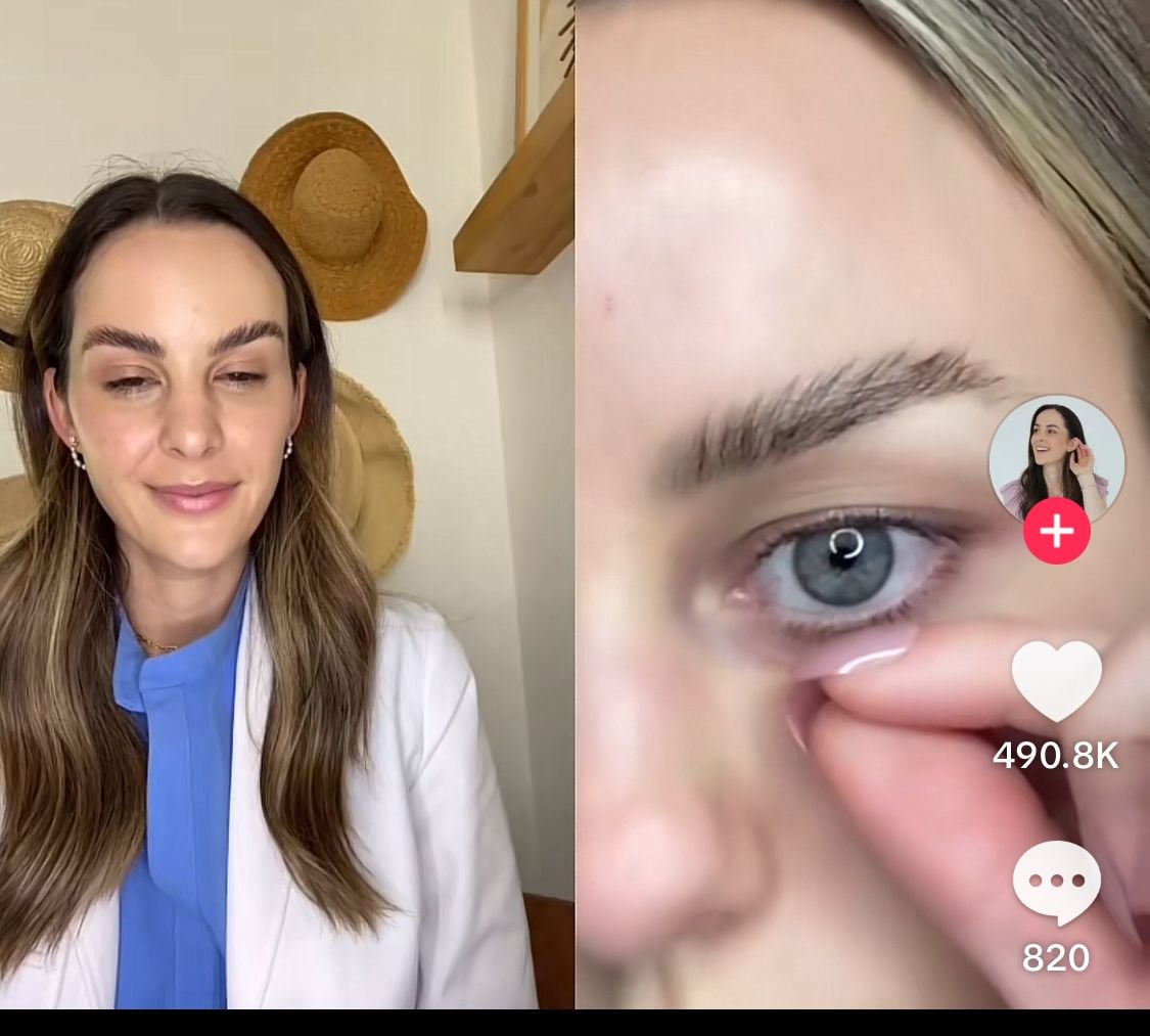 Treating dark circles with a little at home data