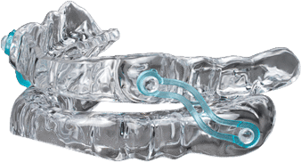 Silent Nite Oral Appliance