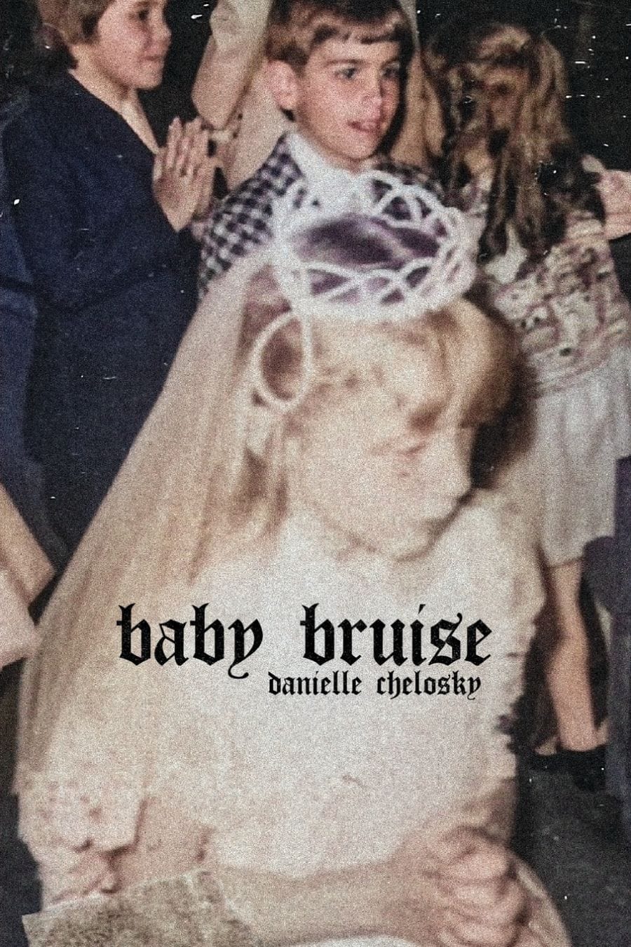 Baby Bruise
