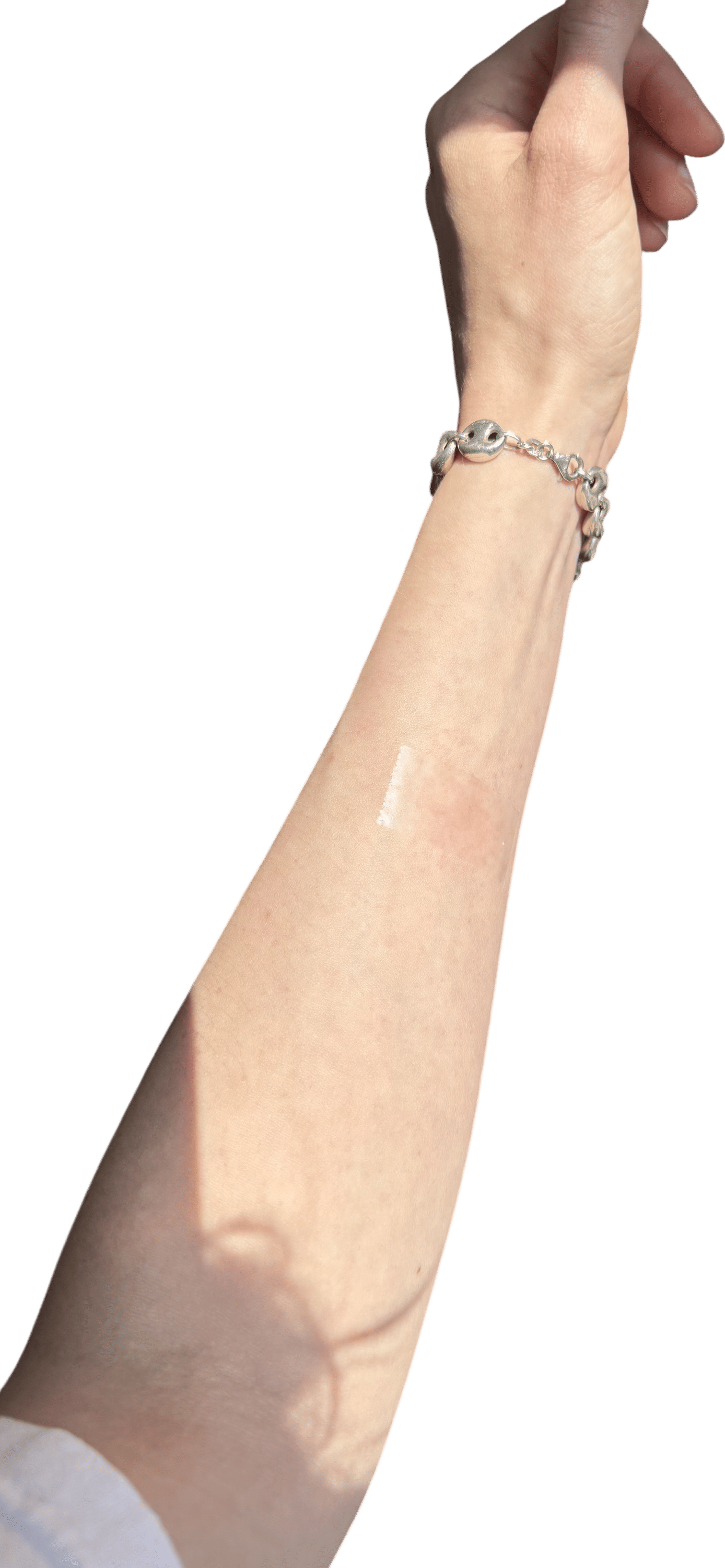 putting scotch tape on mosquito bites