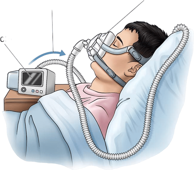 cpap machine