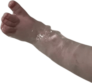 90 second cold foot soak