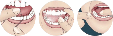 floss first