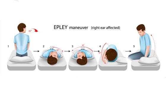 Home Epley Maneuver