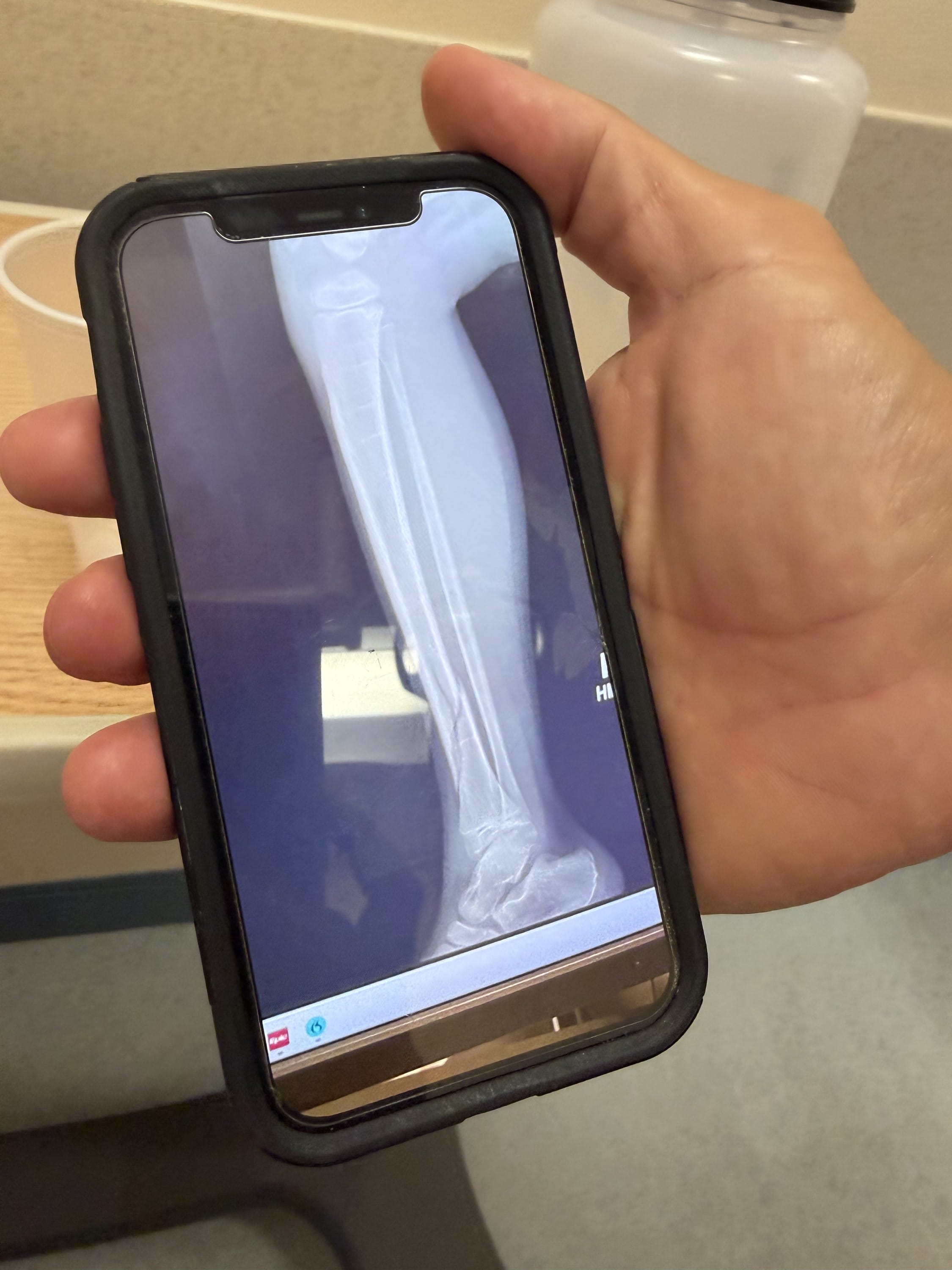 Taking photos of X-rays