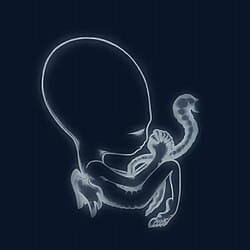 Ágætis byrjun by Sigur Ros (1999)