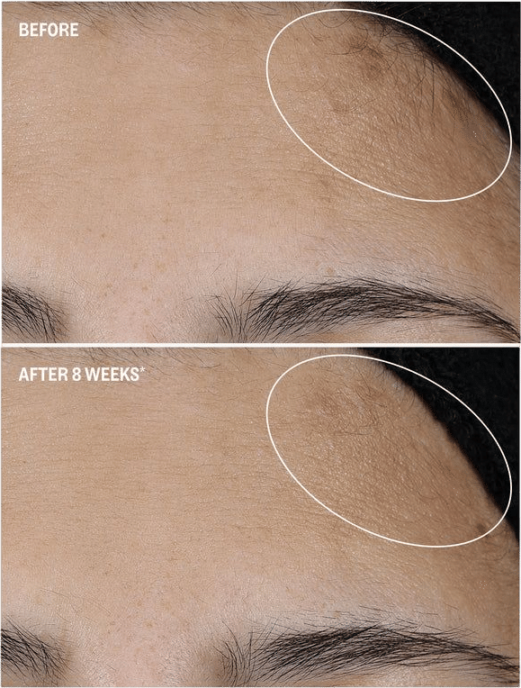 All Bright Vitamin C Serum