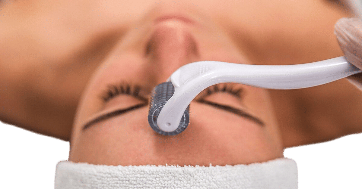 Microneedling