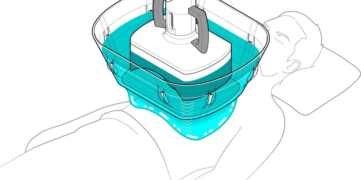 Ultrasound Treatment Takes on Cancer’s Toughest Tumors