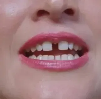 Gap Toothed Women