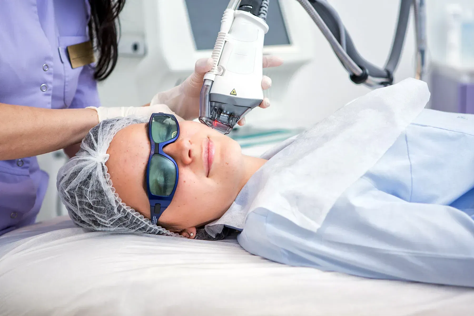 IPL Facial