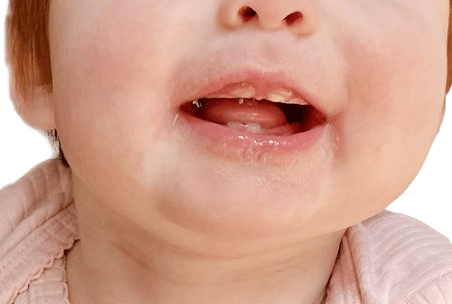 baby teeth