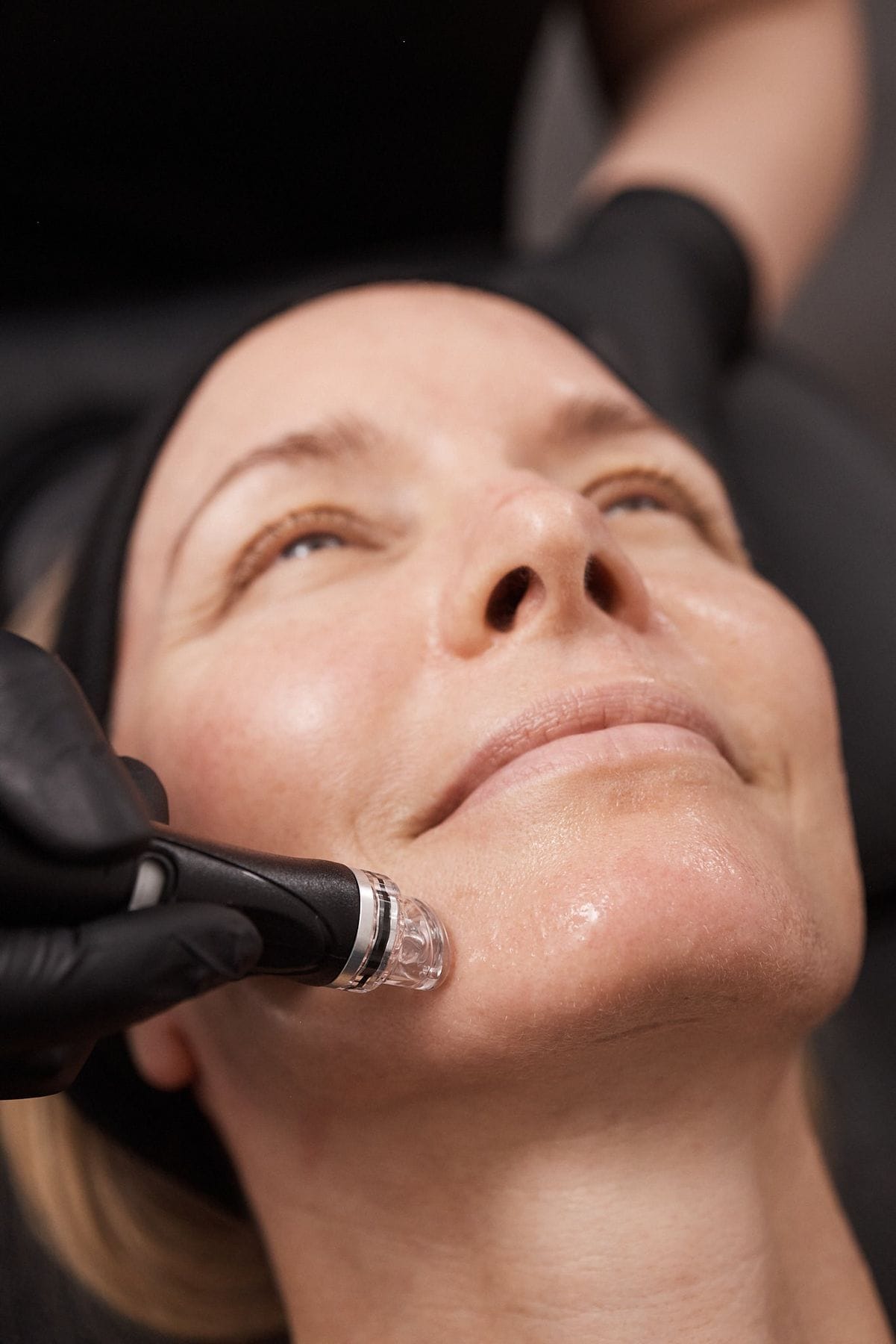 Hydrafacial