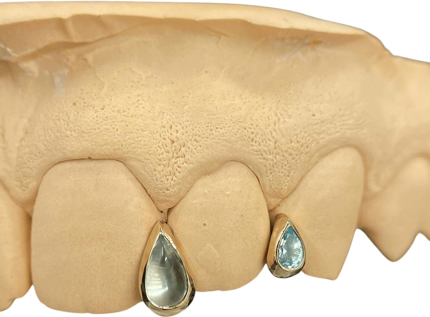 Loud Mouth LDN Custom Grillz