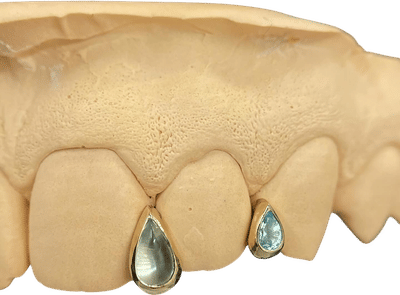 Custom Grillz