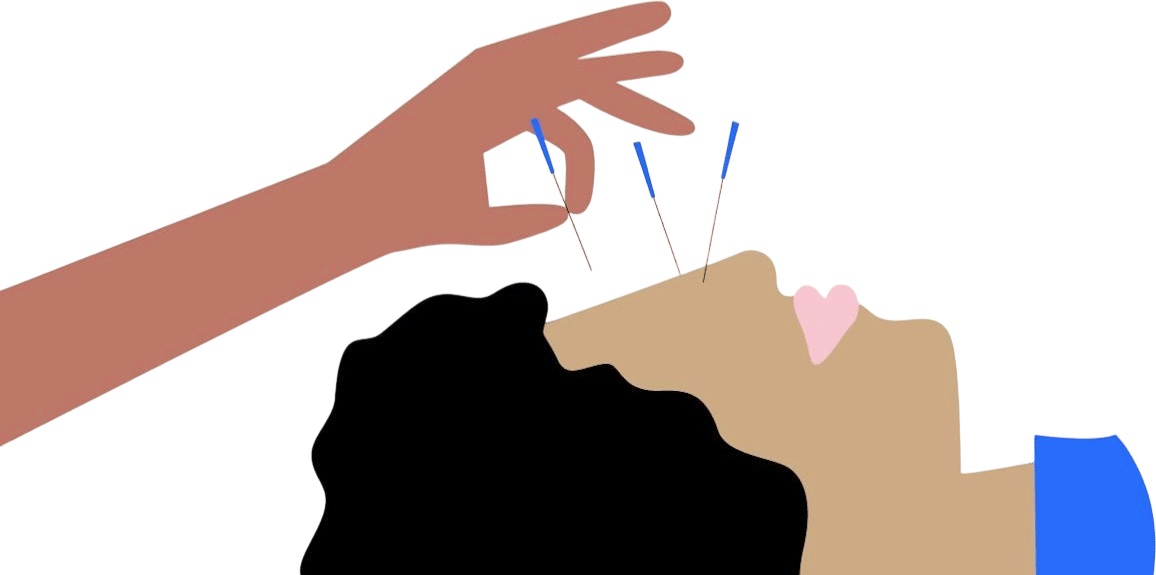 Facial acupuncture