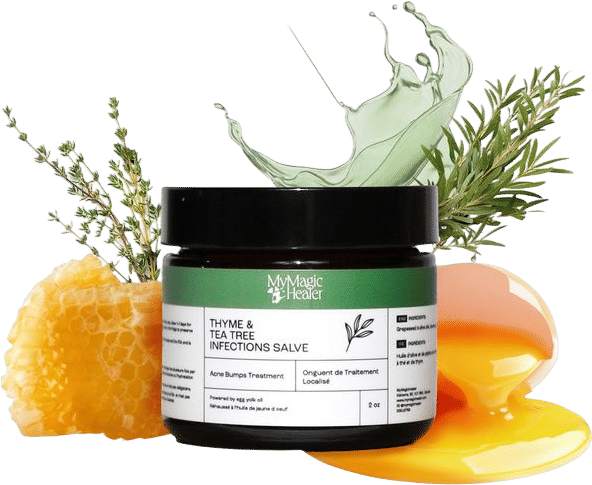 Thyme & Tea Tree Ointment-My Magic Healer