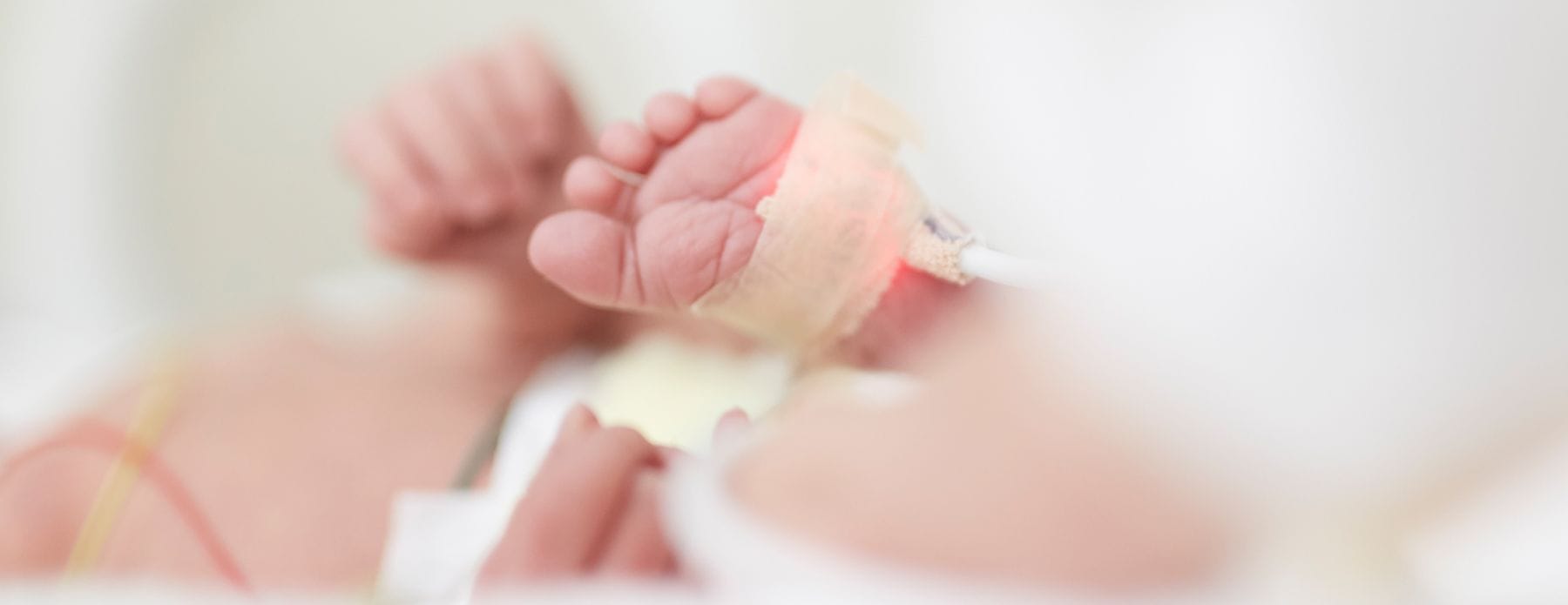 Neonatal Intensive Care Unit at UCSF