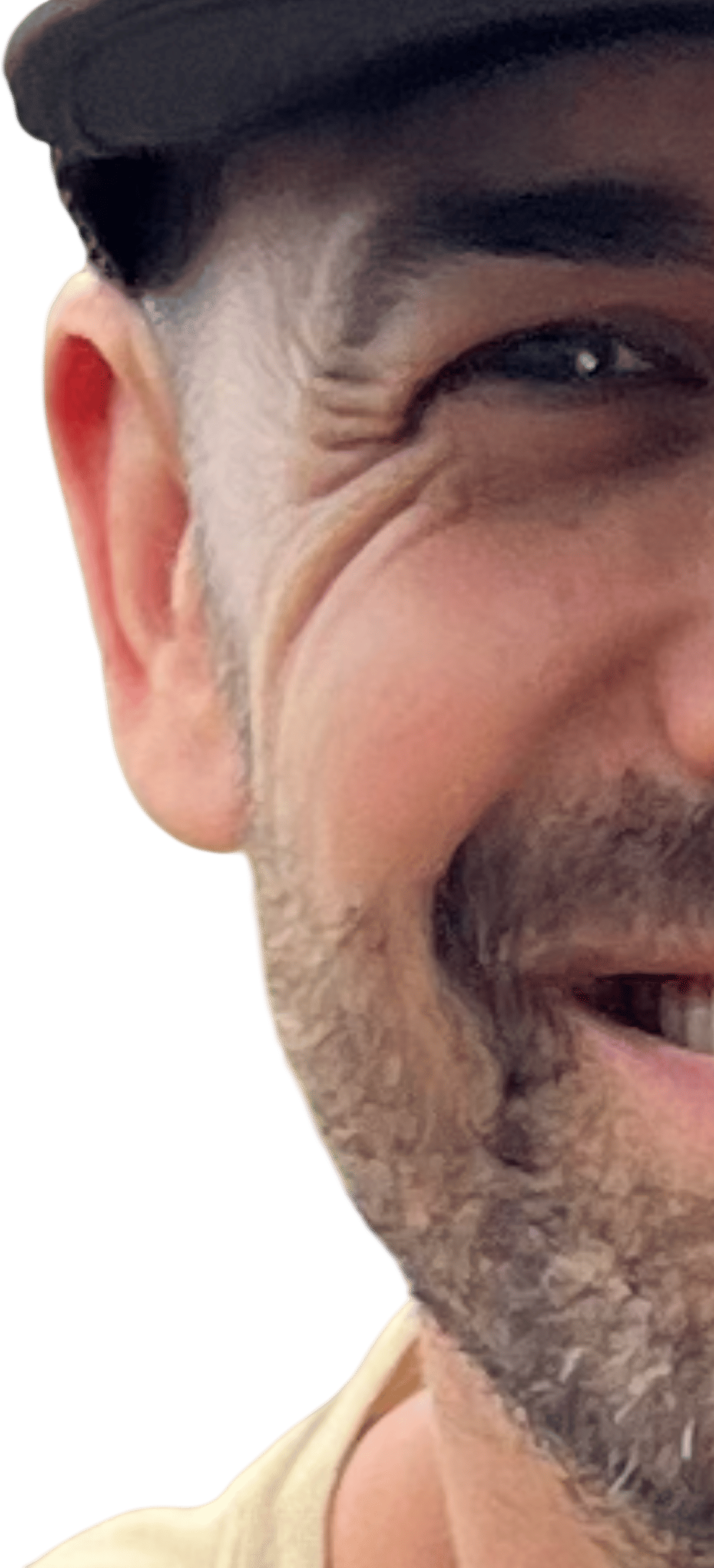 Eye Crinkles